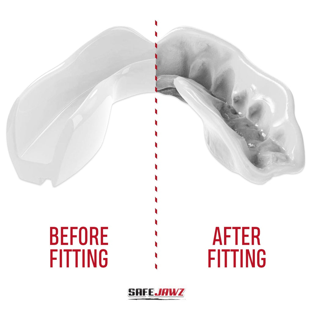 SAFEJAWZ MOUTHGUARD INTRO WHITE